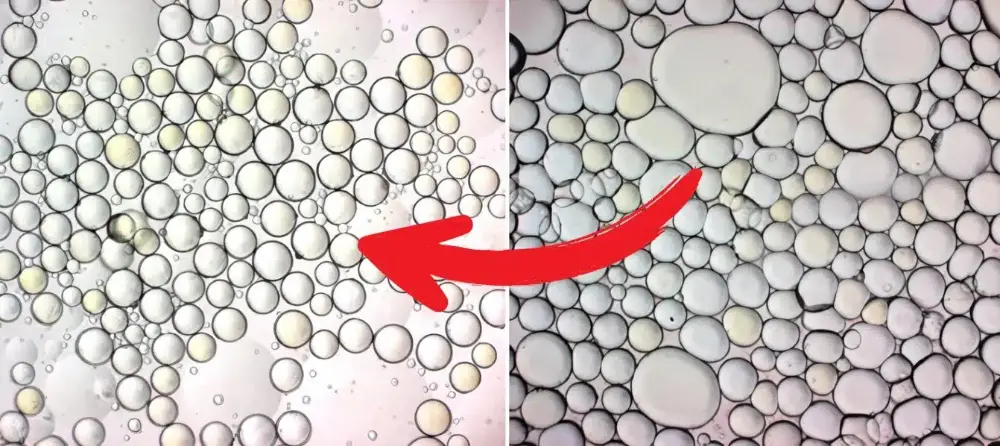Visible Reduction in Fat Cells: Before and After